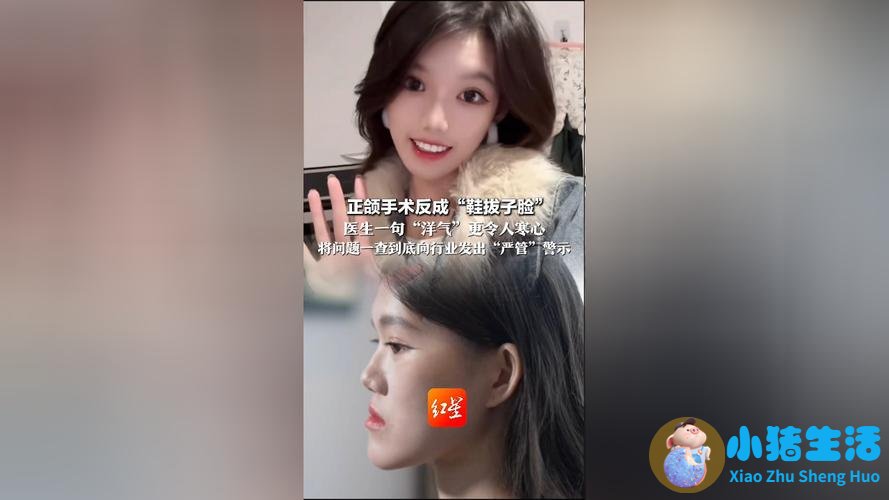 悦美网整形案例