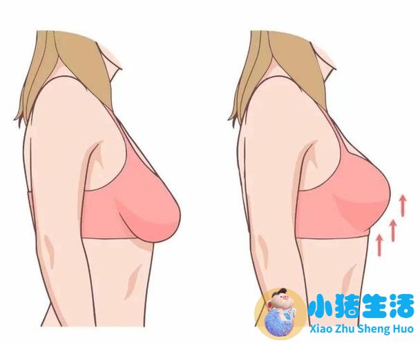 杭州隆胸避坑指南｜想做自然真胸，认准