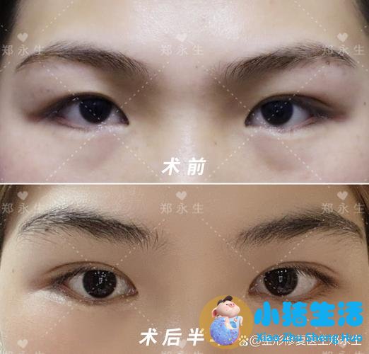 悦美网整形案例