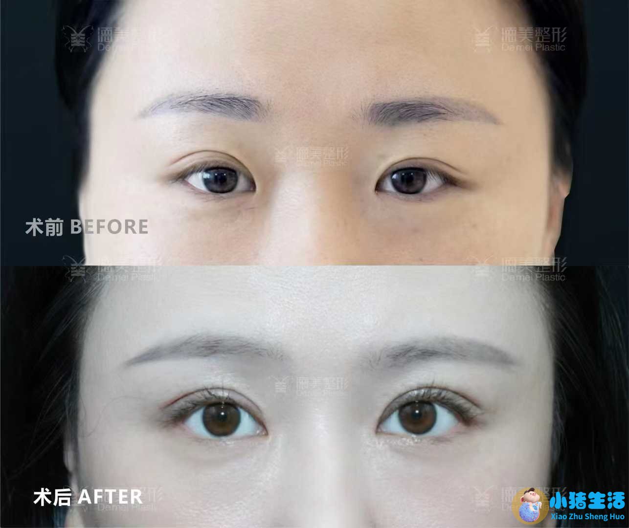 悦美网整形案例