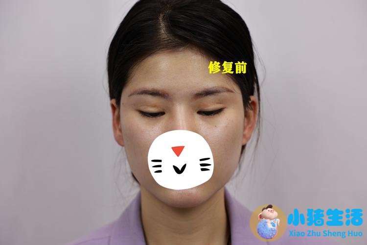 悦美网整形案例