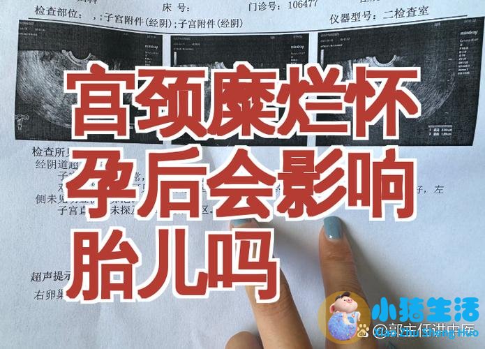 宫颈不好影响怀孕吗