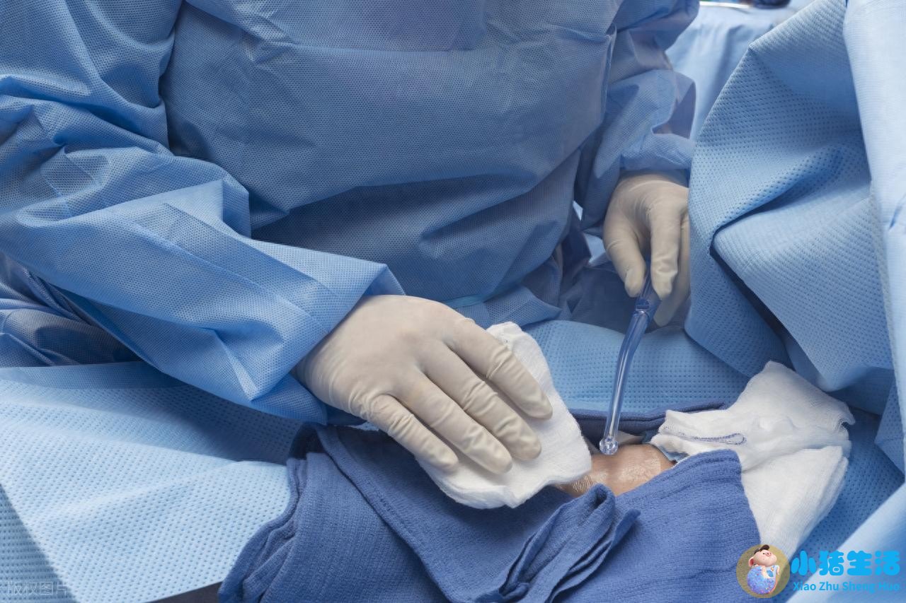 剖腹产对女人的好处在哪？应对难产、护