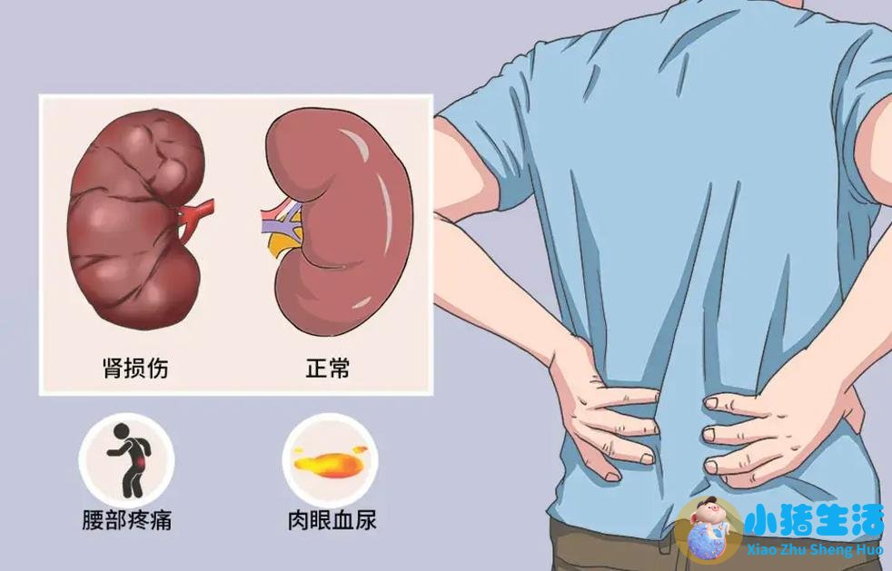 尿路感染与慢性肾病：反复发炎正在悄悄