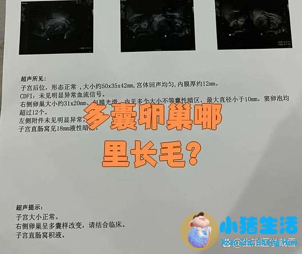 女人乳晕边上长毛是什么原因