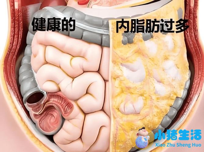 减肥先清理内脏脂肪，一个月稳瘦15斤，