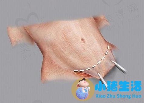 节食减肥方法