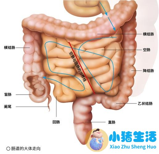 大肠湿热最好中成药