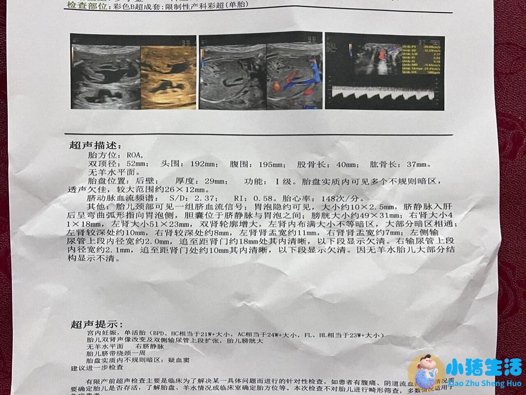 <strong>国家儿童医学中心最新建议：脑积水患儿</strong>