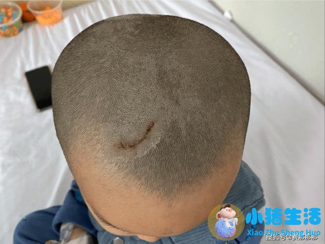 最新医学新闻