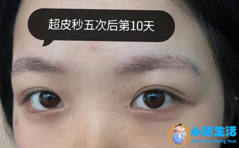 长春国健整形案例