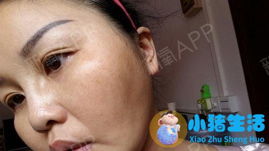 长春国健整形案例