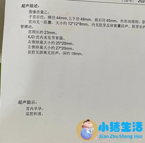 做爱不射在里面能怀孕吗