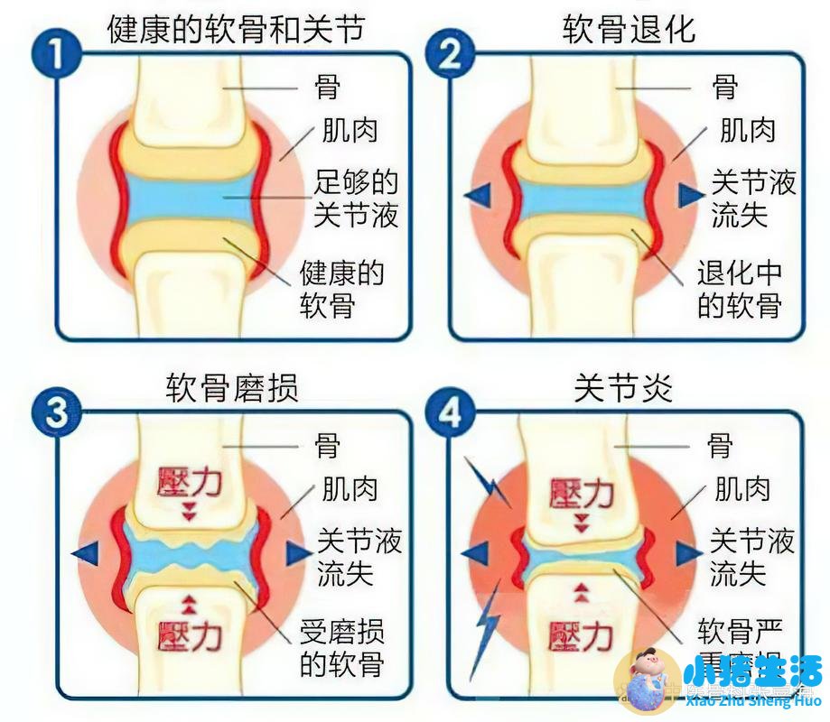 哪种止痛药孕妇可以用