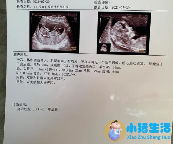 比实际孕周大是男孩吗 〔比〕字拼音是（