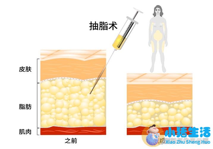 陈妍希减肥方法