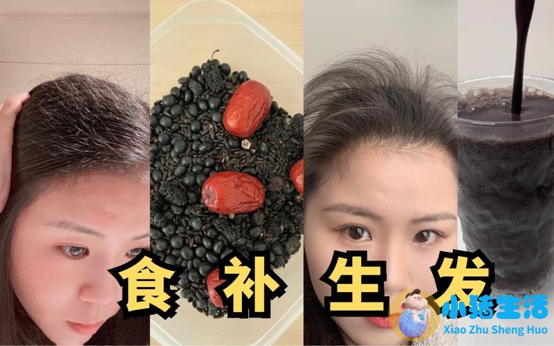 吃什么生发效果最好