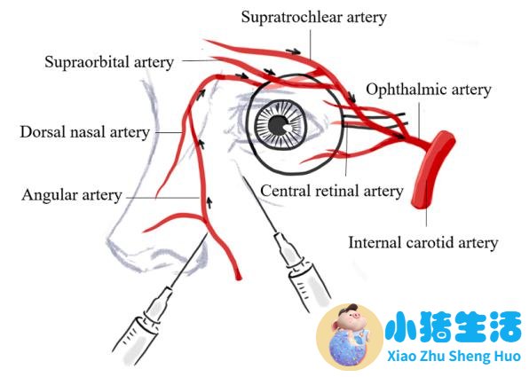 荆州中心医院整形董洁案例