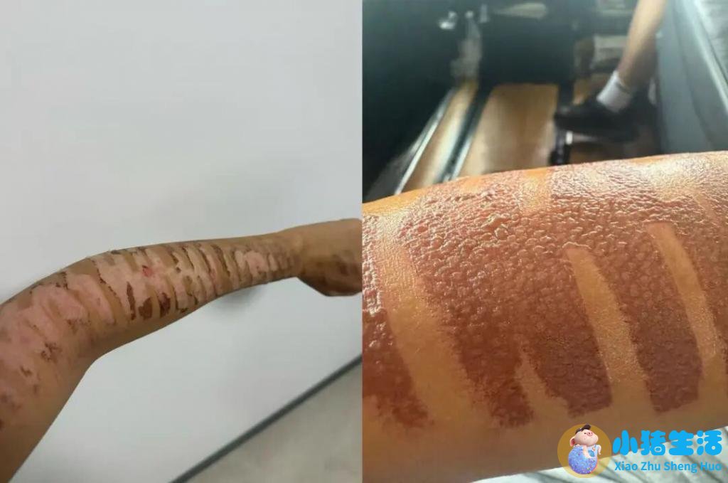 荆州中心医院整形董洁案例