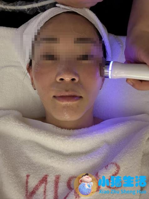 荆州中心医院整形董洁案例