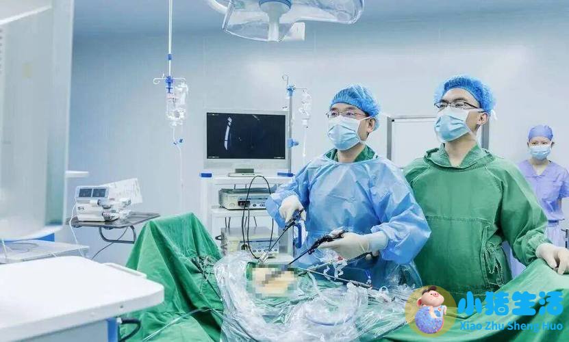 胆结石术后每天需要运动多久