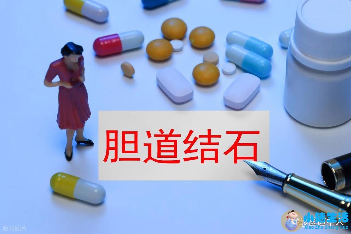 胆结石术后每天需要运动多久