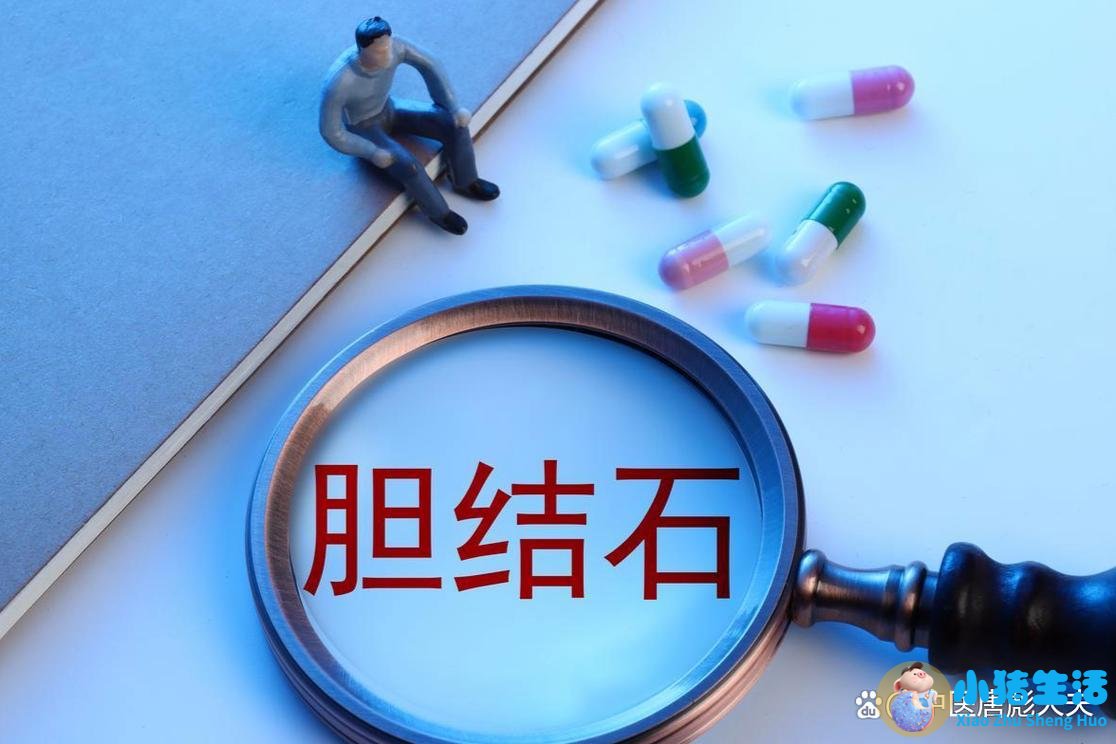 胆结石术后每天需要运动多久