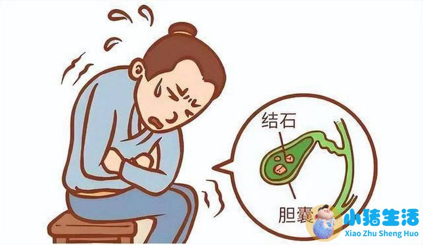 胆结石术后每天需要运动多久