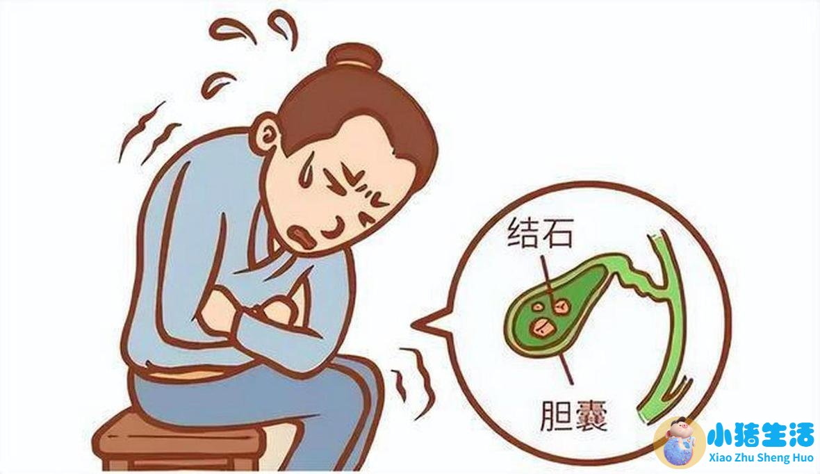 胆结石术后每天需要运动多久