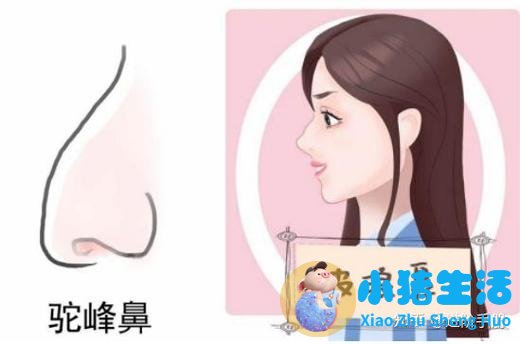 济南玻尿酸注射隆鼻价格